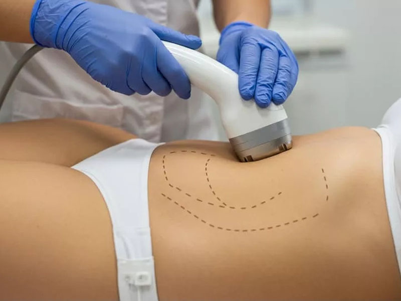 Modelagem Corporal e Ativação Muscular