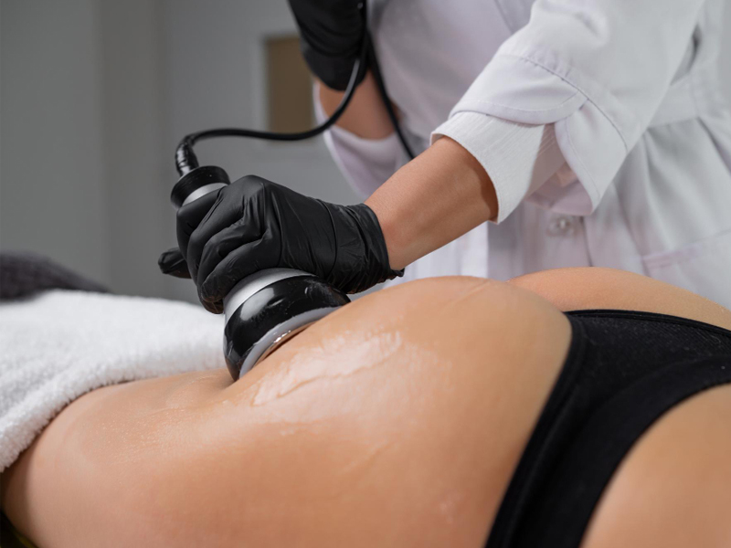 Mais Lieve Corpo – abordagens estéticas integrativas - tratamentos