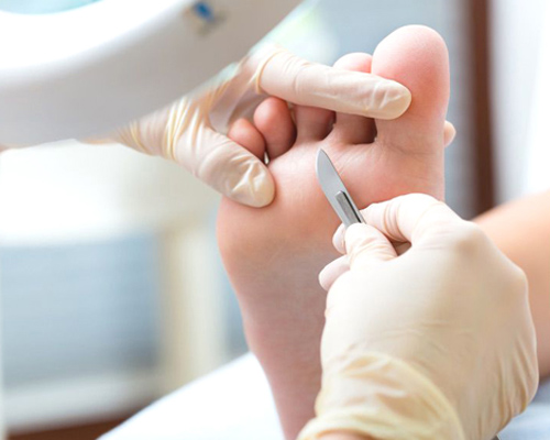 Podologia Estética e Preventiva lieve